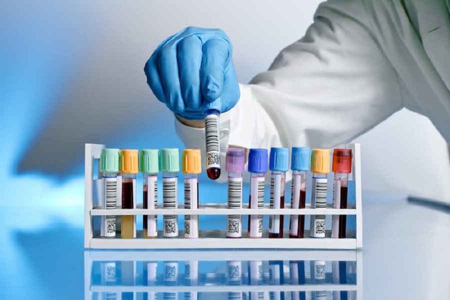 Labels: an important role in laboratory testing
