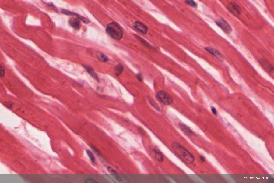 Obesity in pregnancy and risk of cardiovascular disease in offspring