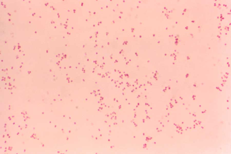 Uncertainty in antimicrobial susceptibility testing of Moraxella catarrhalis