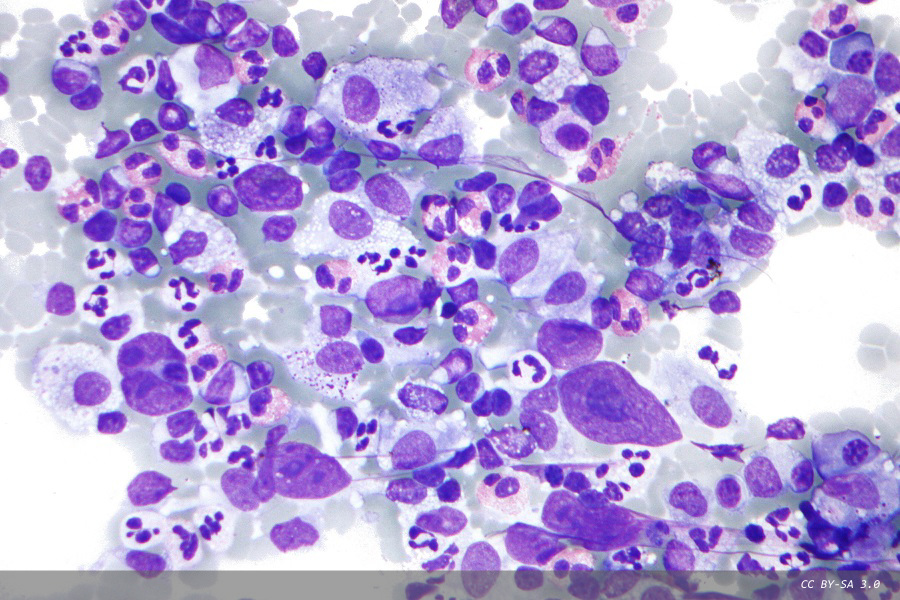 How to avoid the common pitfalls in cytopathology 