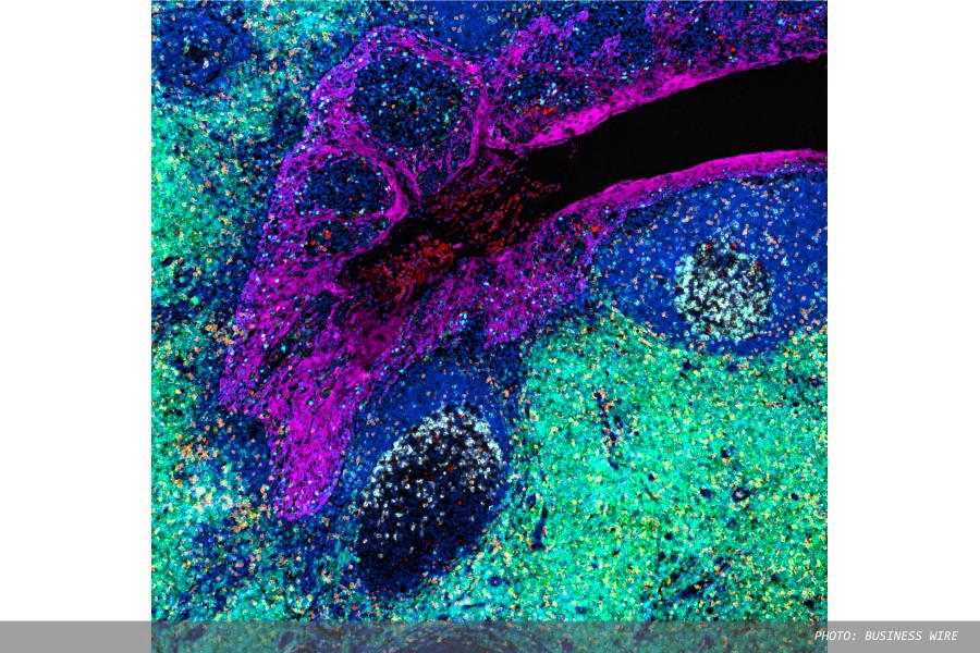 Nucleai and Propath UK announce AI partnership for immuno-oncology