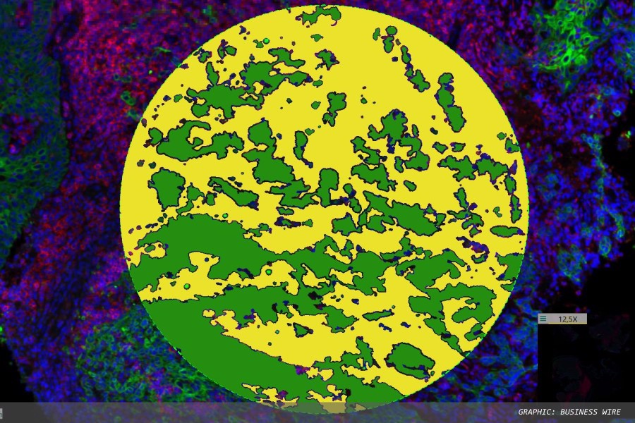 NanoString and Visiopharm announce collaboration on GeoMx workflow
