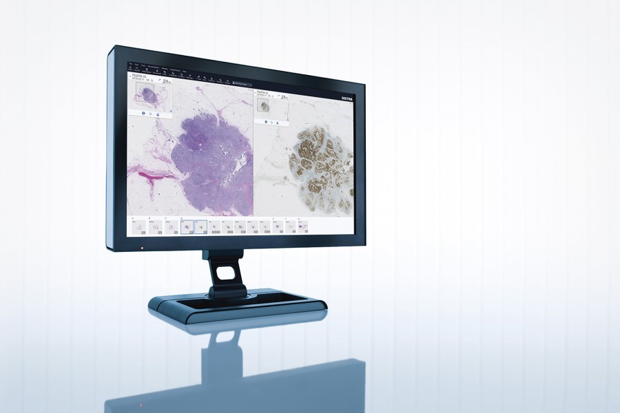 French hospital group moves to digital pathology with Sectra