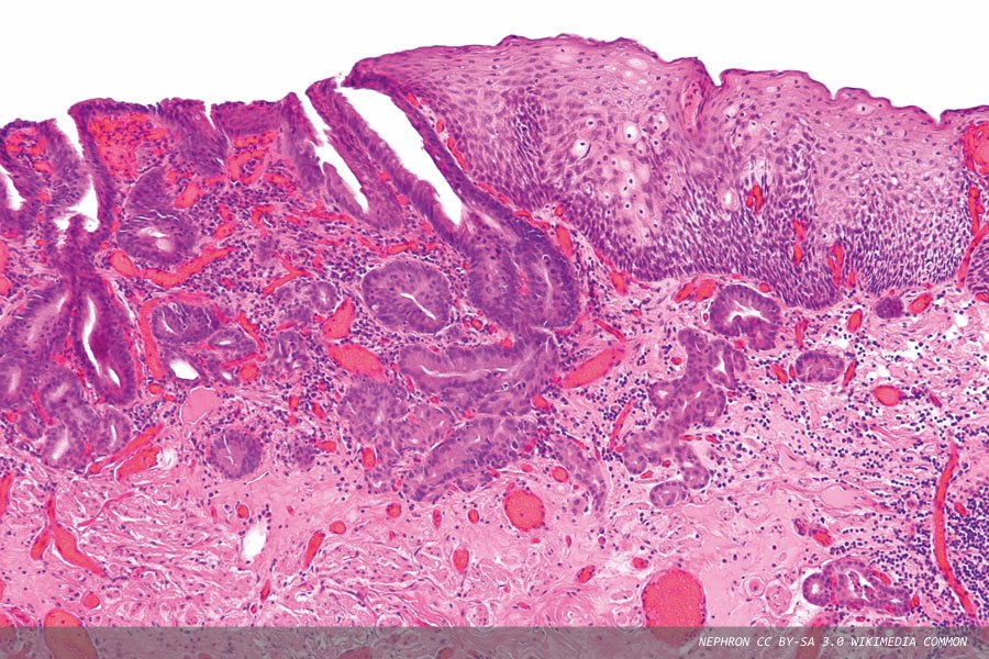 Messenger RNA: a basis for vaccine technology and cancer treatment