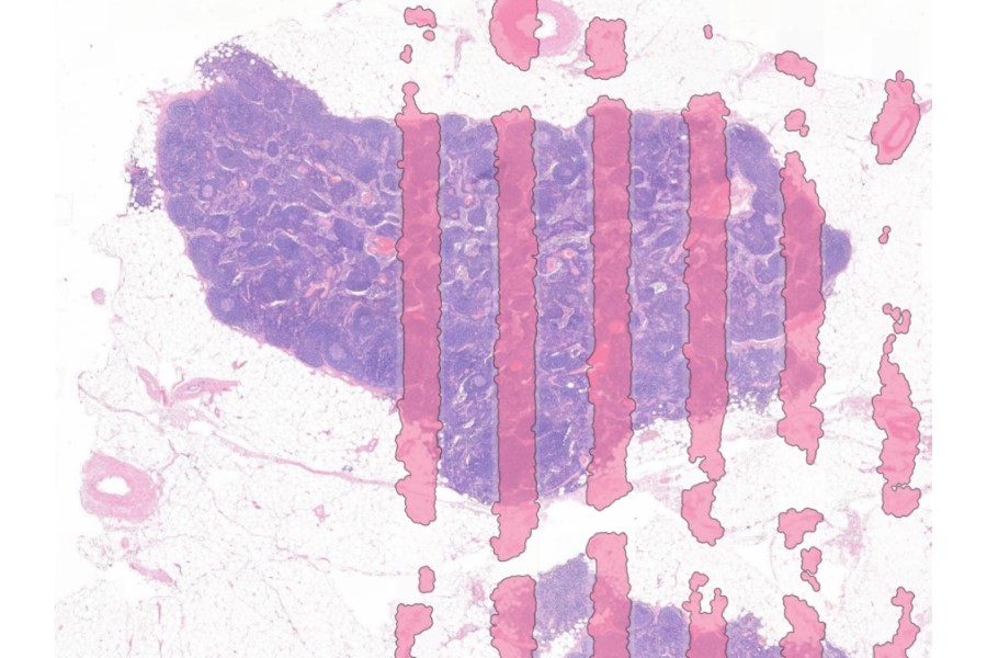 Aiosyn launches AI-powered QC for digital pathology workflow