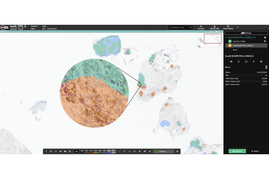 Indica Labs and Lunit announce alliance for digital pathology