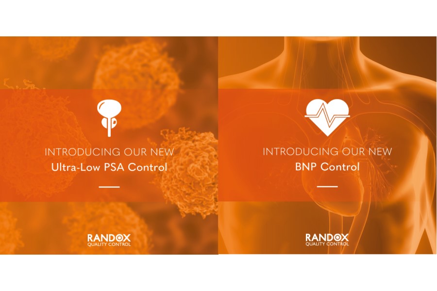 Two new launches of controls from Randox