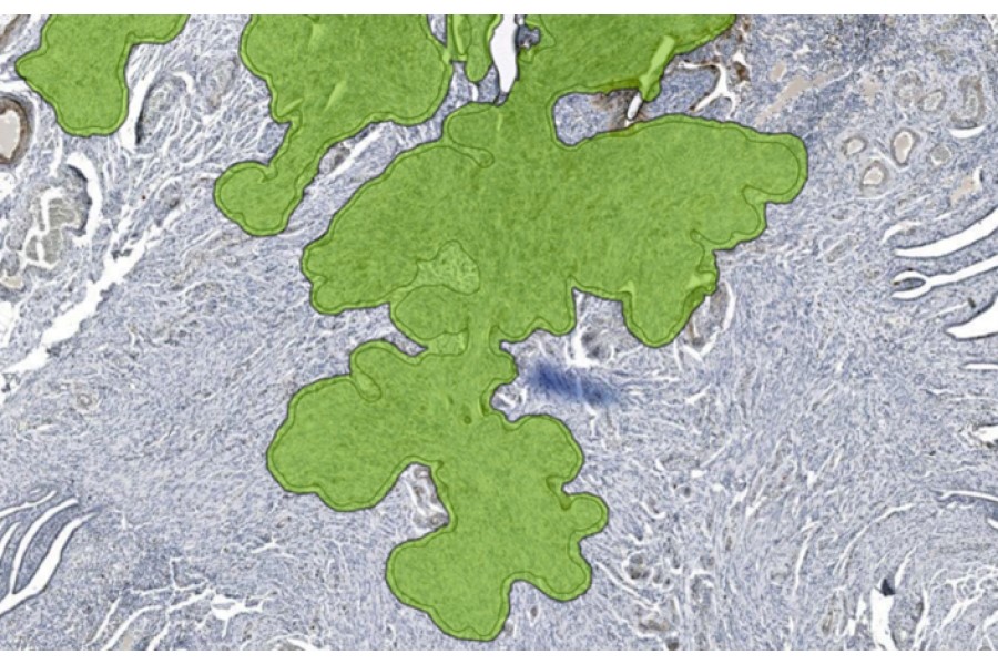 Aiosyn expands its AI-powered QC for digital pathology to support IHC staining