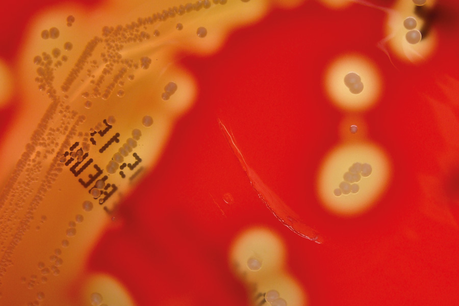 Group A Streptococcus: introducing a rapid molecular POC test