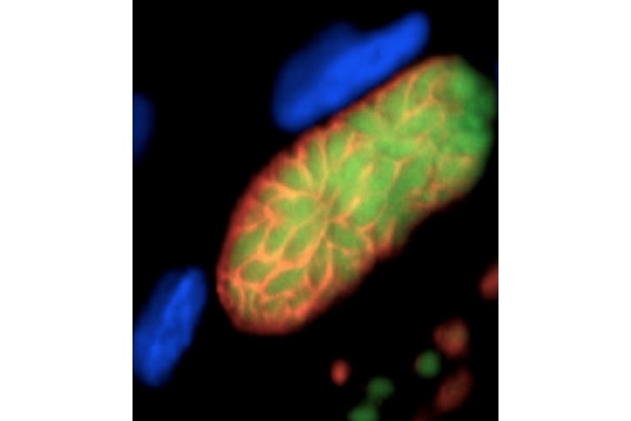 POC test rapidly diagnoses Toxoplasma infections