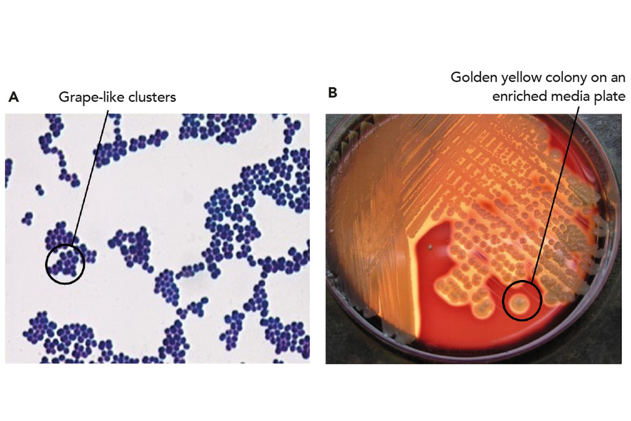 Enhanced in-house MRSA testing algorithm for detecting PVL toxins