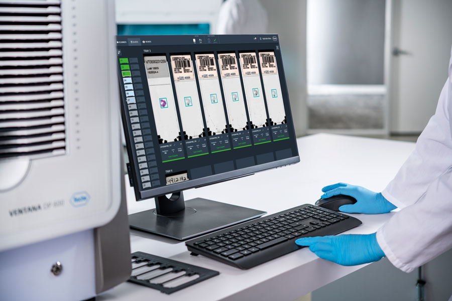 Roche receives FDA clearance on its digital pathology solution for diagnostic use