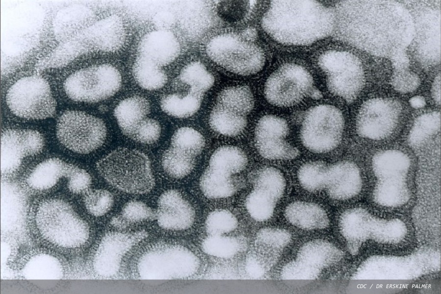 Simple test for influenza could improve diagnosis and surveillance