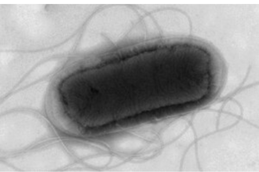 New cases slowing in Escherichia coli outbreak