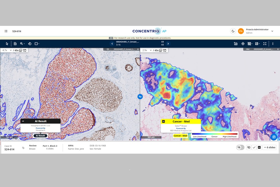 Proscia introduces major update to Concentriq AP