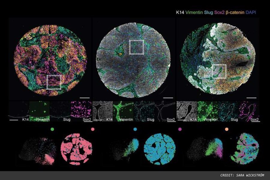 New imaging analysis for head and neck cancer diagnostics