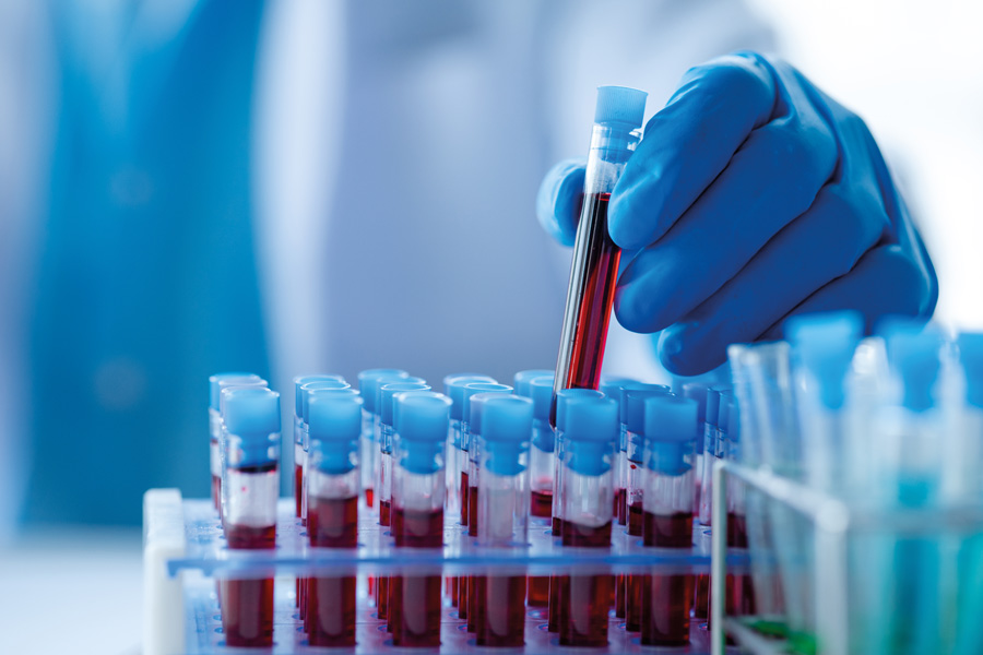 ED testing finds thousands with undiagnosed HIV, hepatitis B and C