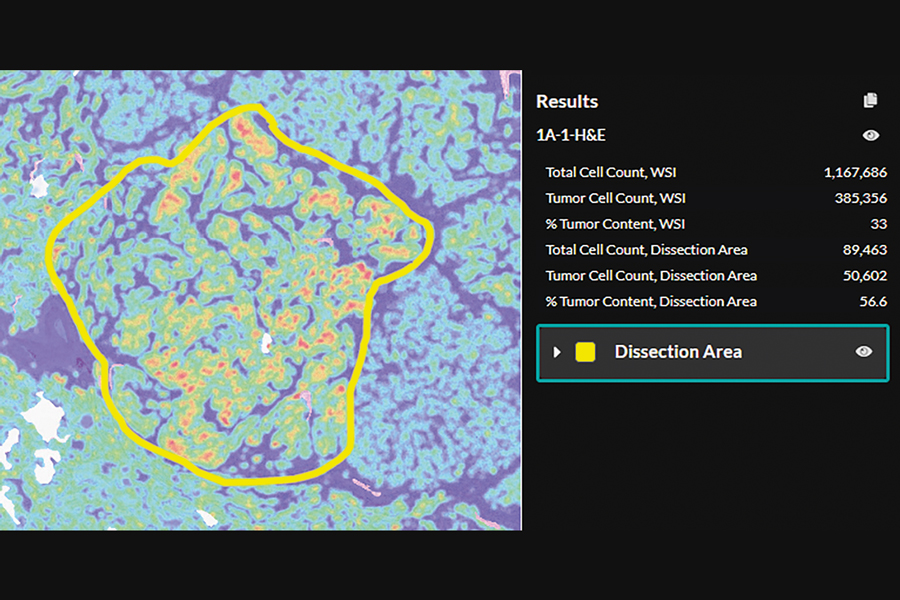 Harnessing AI for digital pathology in clinical and diagnostic workflows