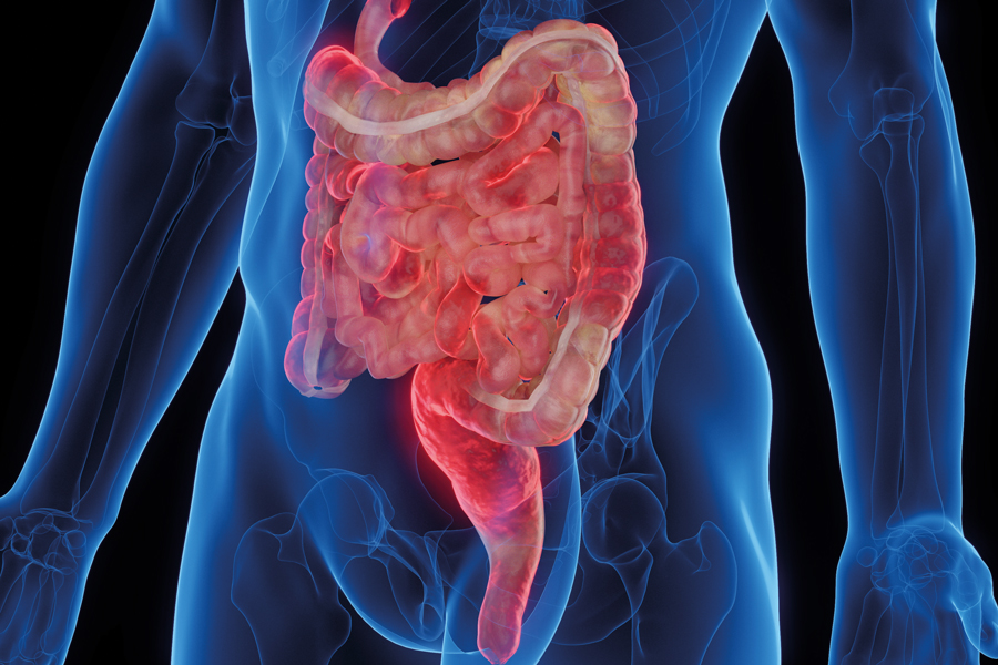 Advancing drug monitoring for better IBD outcomes