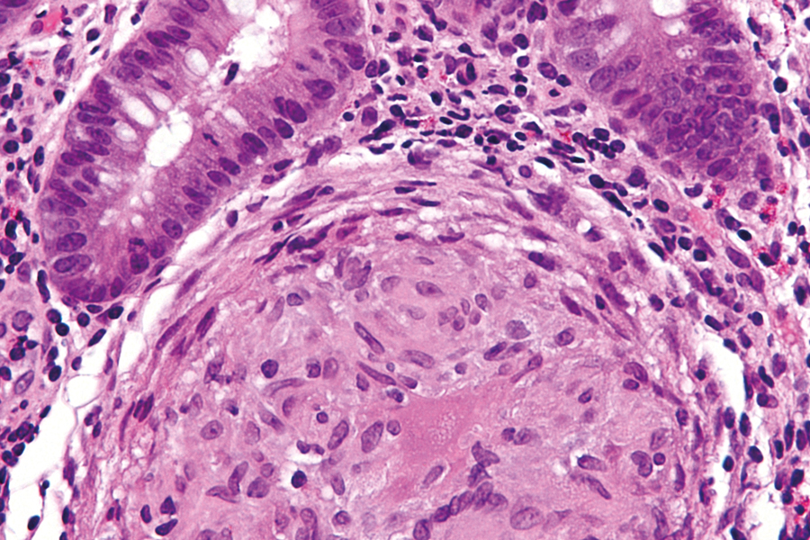 Inflammatory bowel disease: a selection of current research interest