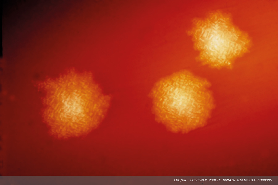 Laboratory Microbial Diagnostics: Current and Future Practice